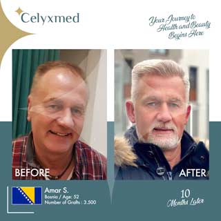 Celyxmed