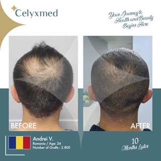 Celyxmed