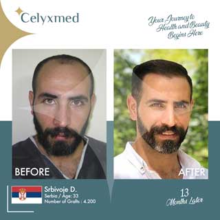 Celyxmed
