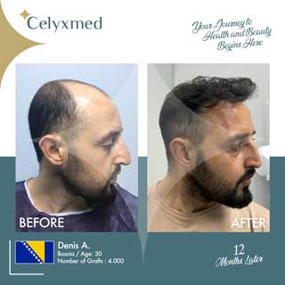 Celyxmed