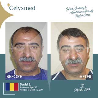 Celyxmed