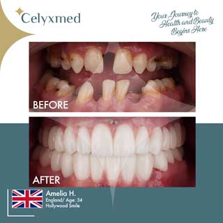 Celyxmed